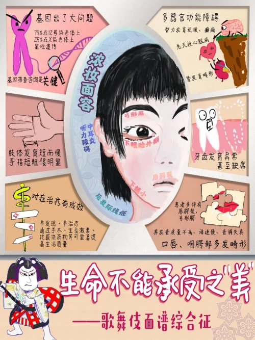 歌舞伎面具综合症图片